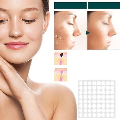 Skanto | SkinClear - Plaster for the removal of spots and warts