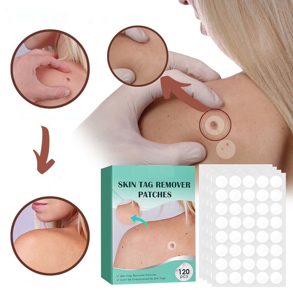 Skanto | SkinClear - Plaster for the removal of spots and warts