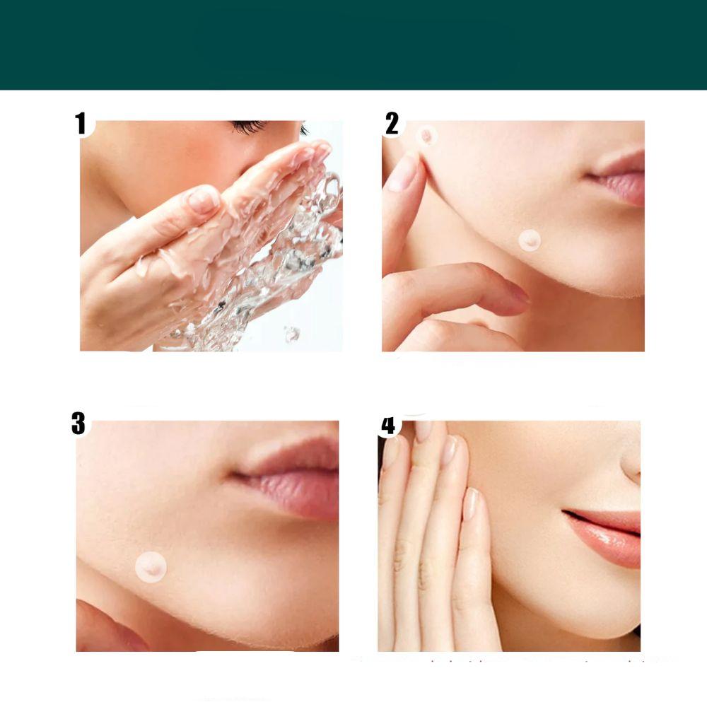 SkinClear - Patch for the removal of spots and warts Bowlift