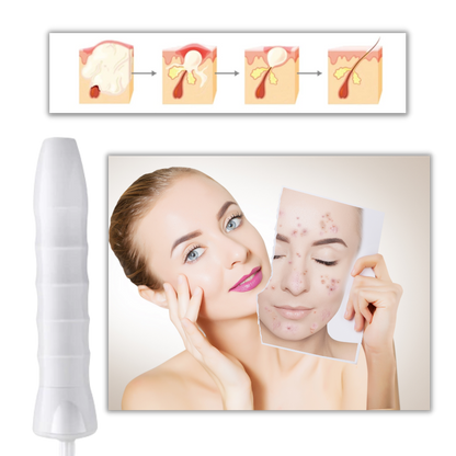 Light Therapy for Aging Skin