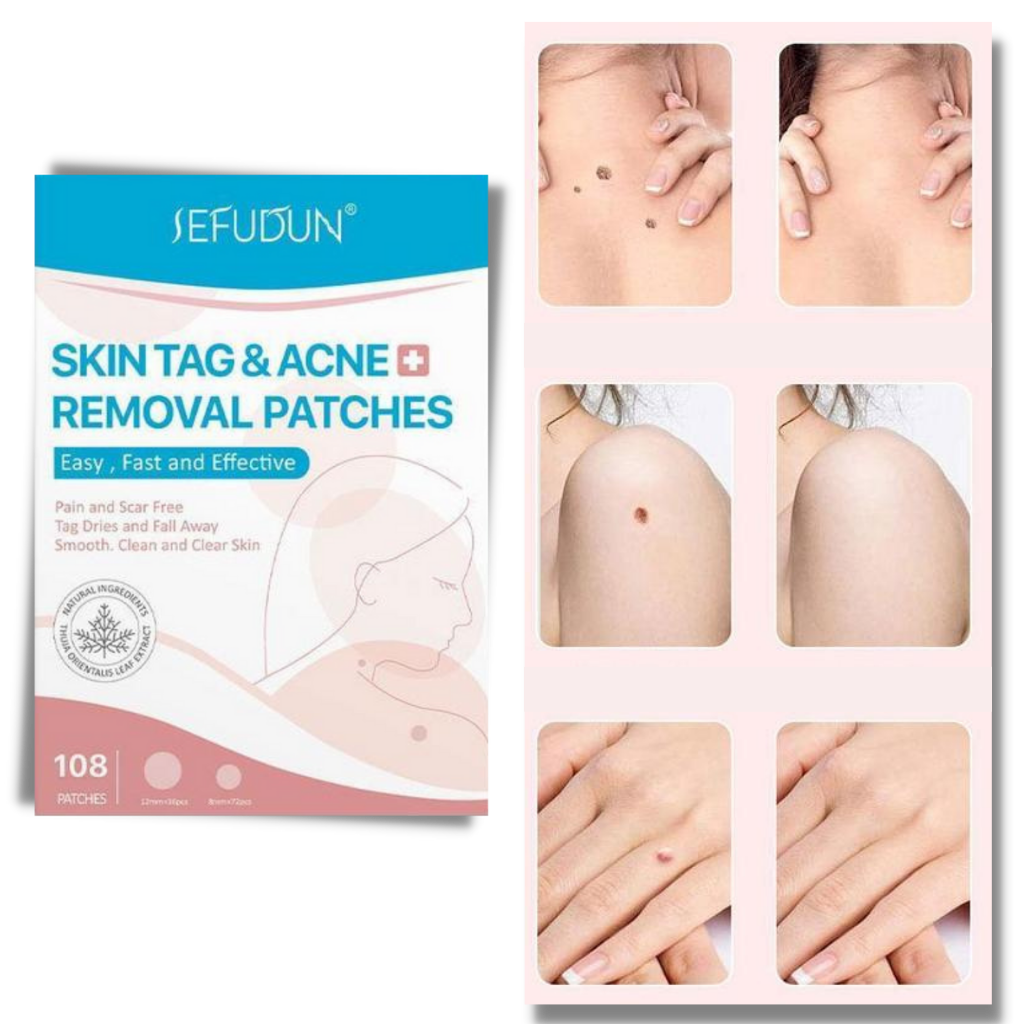Skanto | Skin Plasters - Remove Moles and Warts Naturally!