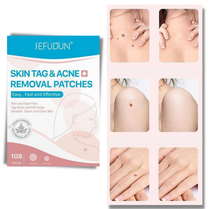 Skanto | Skin Plasters - Remove Moles and Warts Naturally!