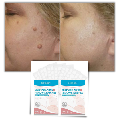 Skanto | Skin Plasters - Remove Moles and Warts Naturally!