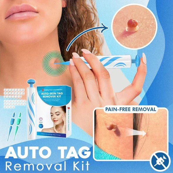 Skanto | Quick Removal Kit