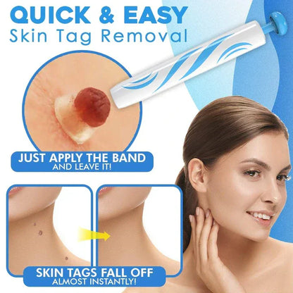 Quick-Removal Kit