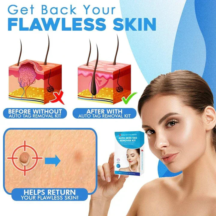 Quick-Removal Kit