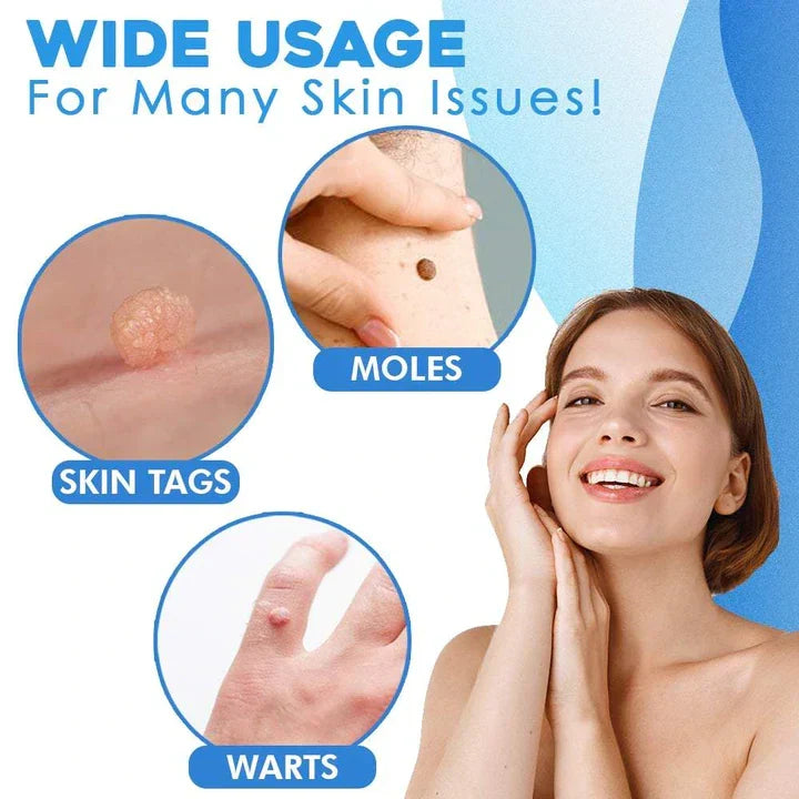 Quick-Removal Kit