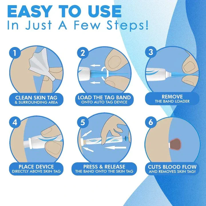 Quick-Removal Kit