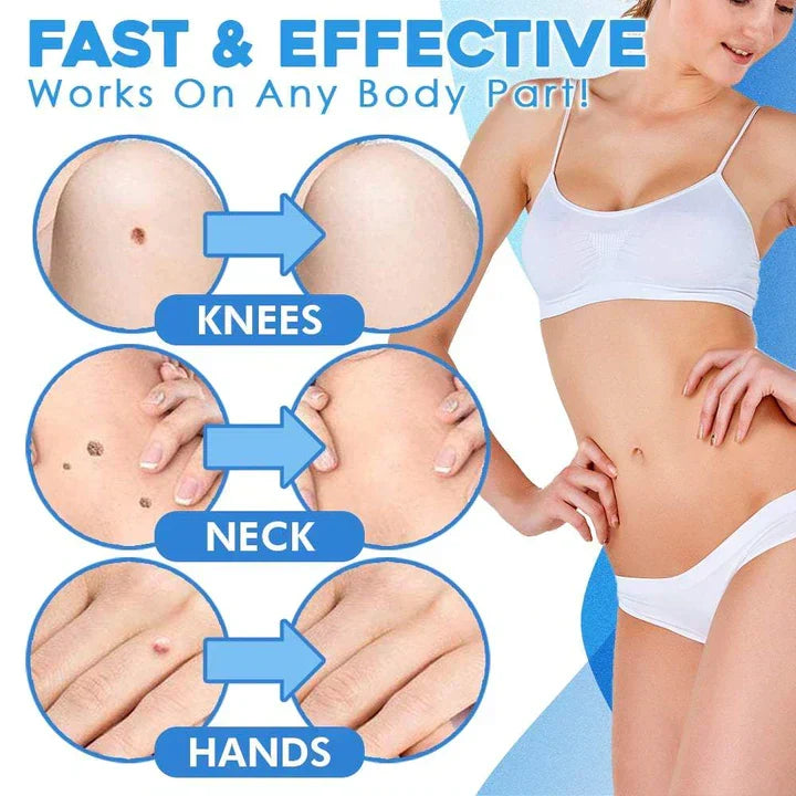 Skanto | Quick Removal Kit