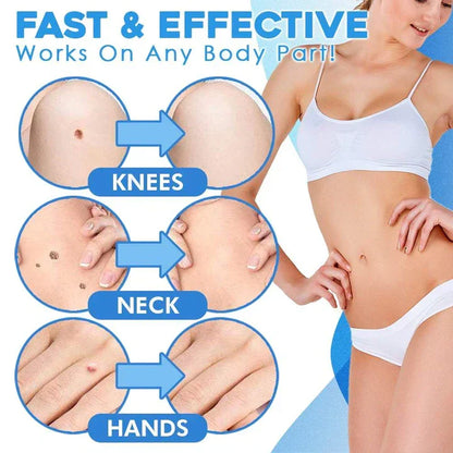 Skanto | Quick Removal Kit