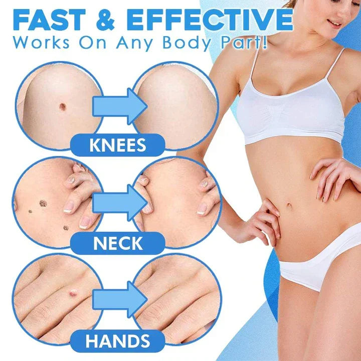 Quick-Removal Kit