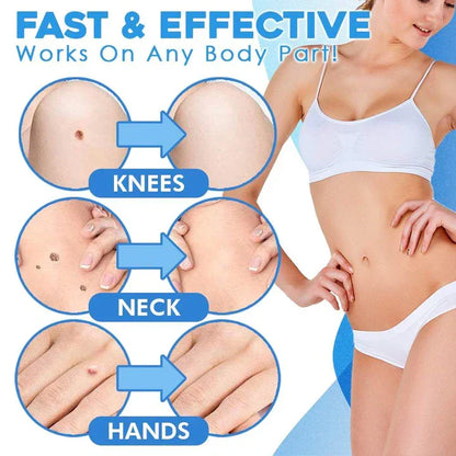 Quick-Removal Kit