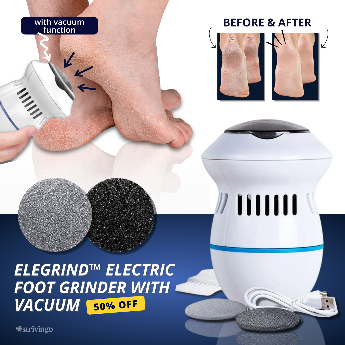 Electric Foot Care Professional | No More Calluses! | Skanto