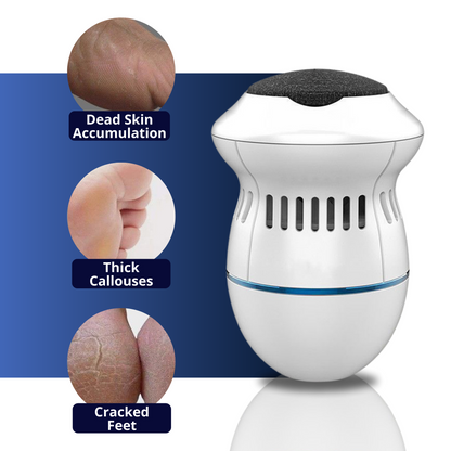 Electric Foot Care Professional | No More Calluses! | Skanto
