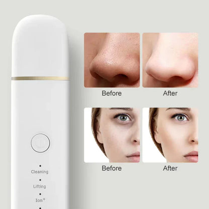 BowLift | Skin scrubber for deep cleansing