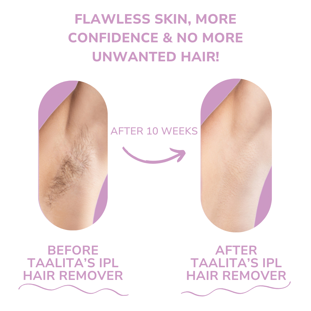 Brehn | SmoothWave™ IPL Hair Remover