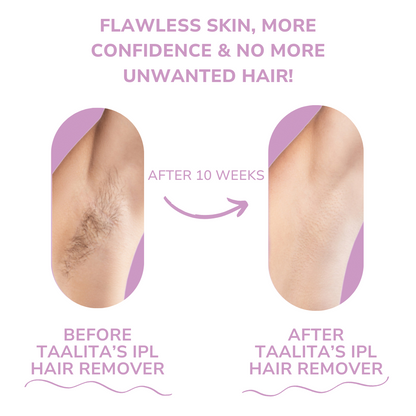Brehn | SmoothWave™ IPL Hair Remover