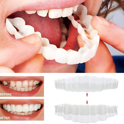 BowLift | Removable Veneers Teeth Cover