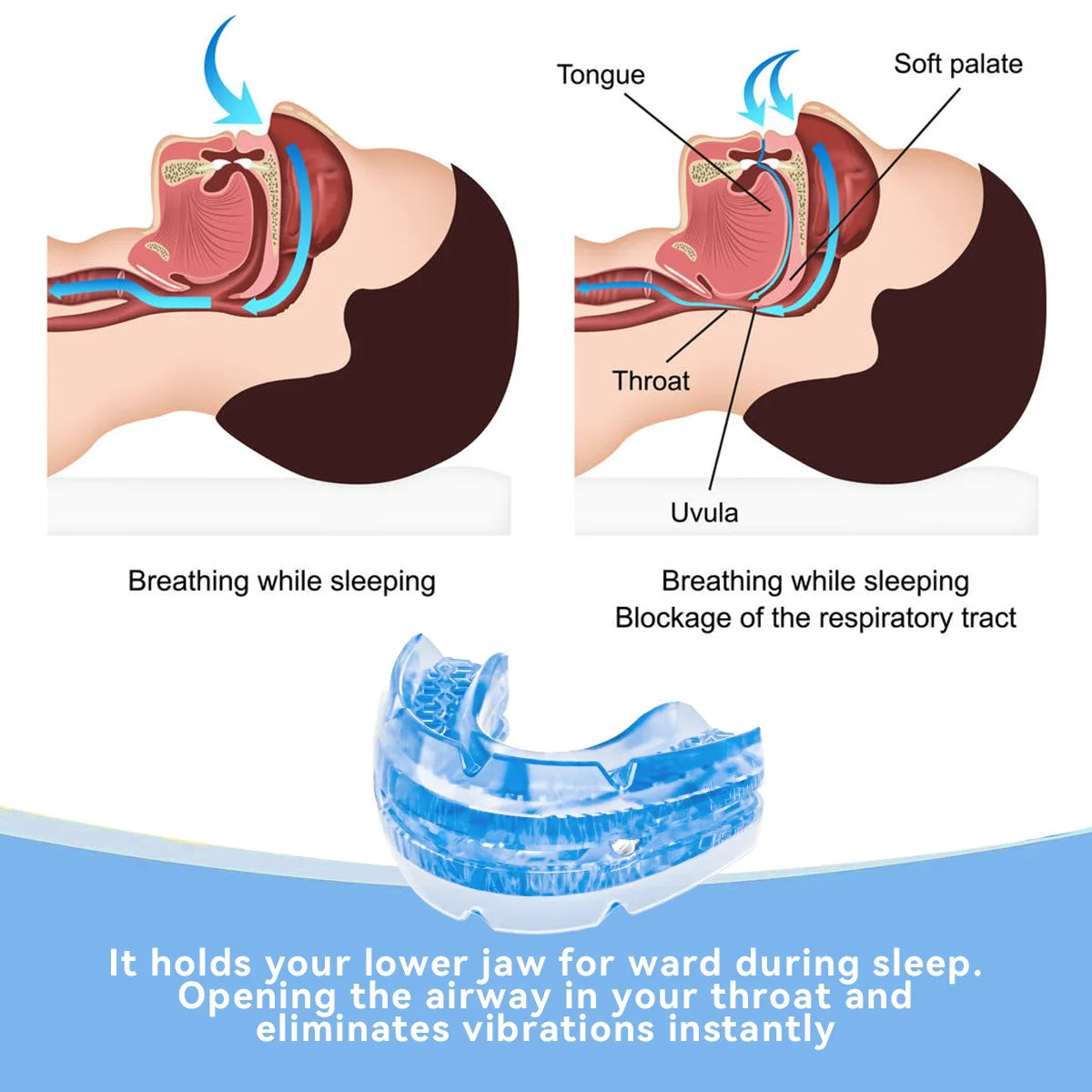 Skanto | Adjustable Anti-Snoring Mouthpiece Made of BPA-Free Material