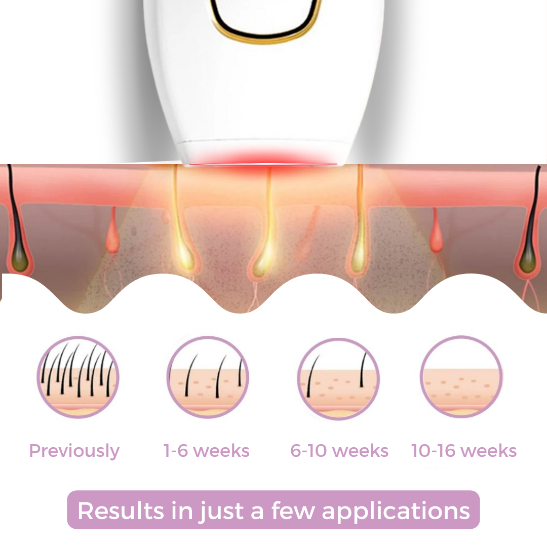Brehn | SmoothWave™ IPL Hair Remover
