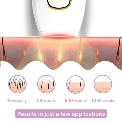 Brehn | SmoothWave™ IPL Hair Remover