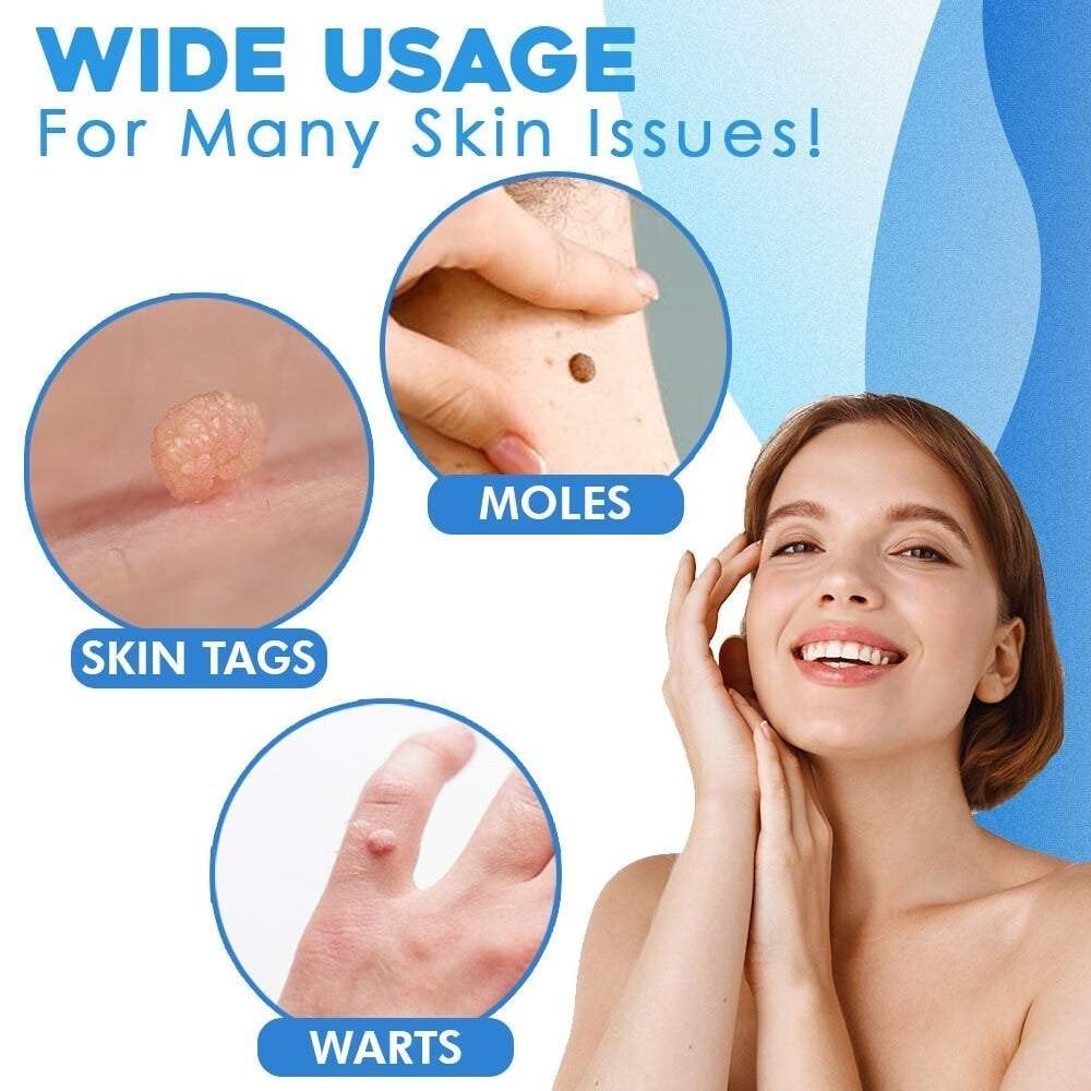Skanto | SmoothZap — Faster pain-free skin freedom for a new sense of confidence in just 10 days
