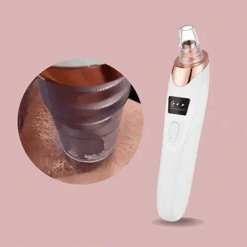 Skanto | Nano Electric Vacuum Blackhead Remover — Unleash Your Radiant, Clear Skin Without Pain or Stress