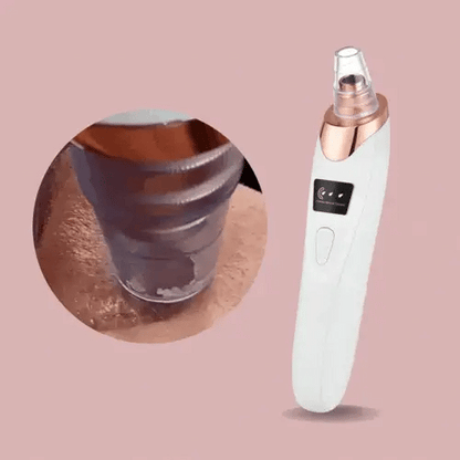 Skanto | Nano Electric Vacuum Blackhead Remover — Unleash Your Radiant, Clear Skin Without Pain or Stress