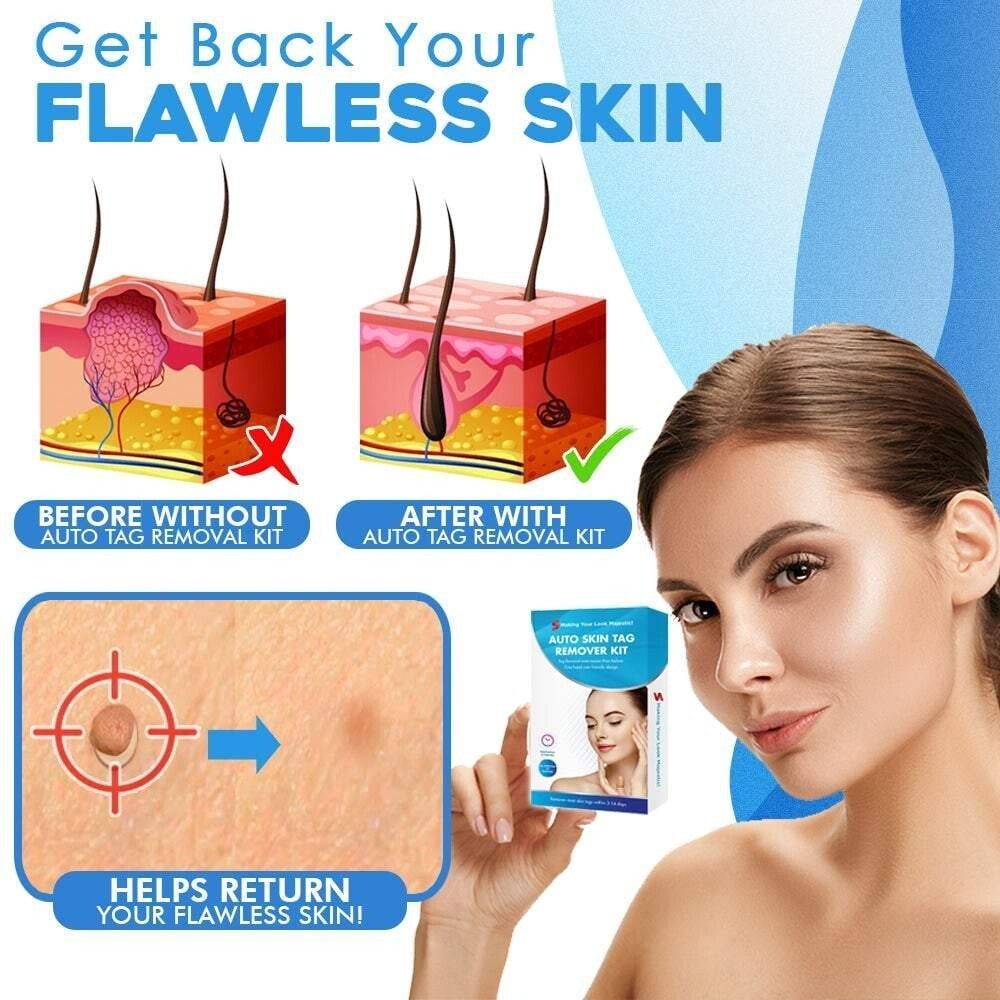 Skanto | SmoothZap — Faster pain-free skin freedom for a new sense of confidence in just 10 days