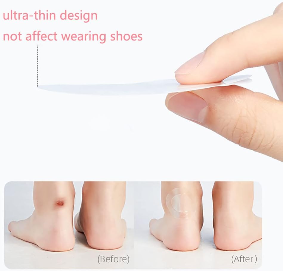 BowLift | SootheStep – Transparent Gel Pads that instantly prevent blisters