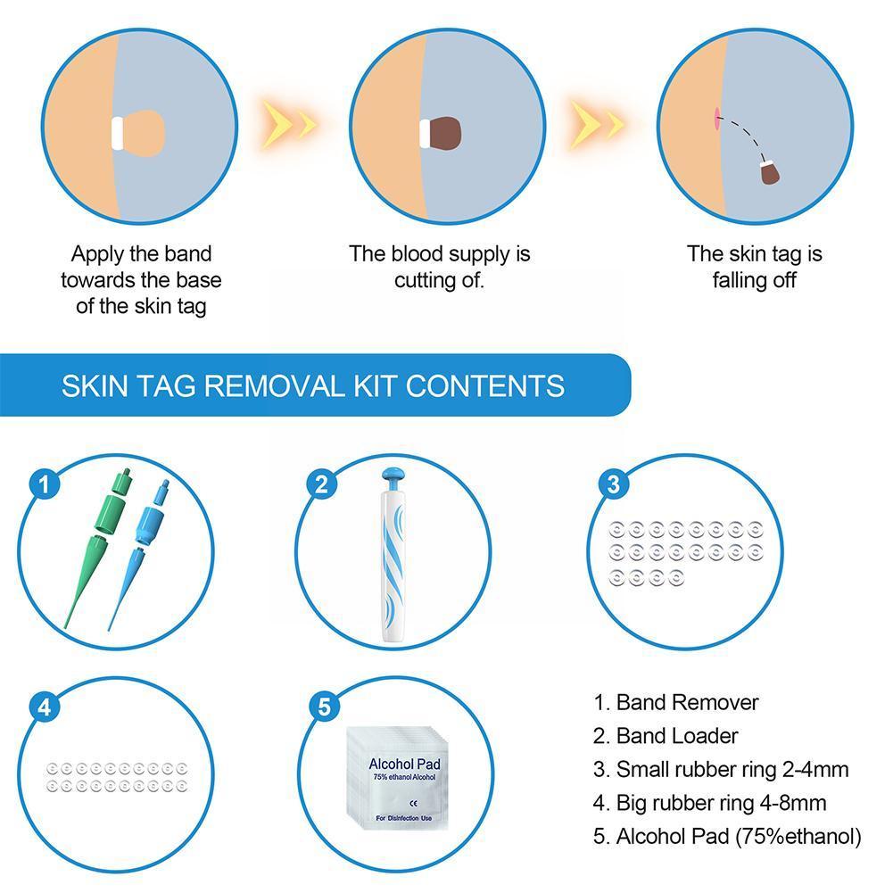 Skanto | Auto Skin Tag Remover Painless