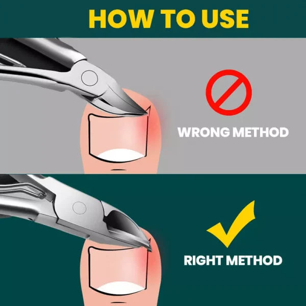 BowLift | Orthopedic Nail Clipper