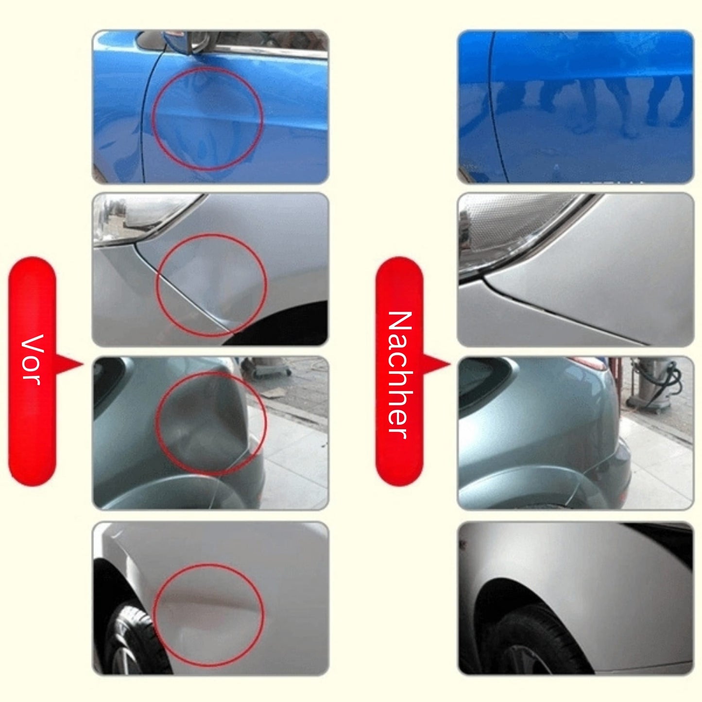DeukFix Repair Kit – Car Dent Removal without Paint Damage | Karnz