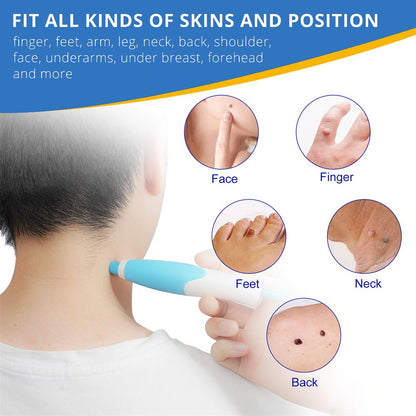 BowLift | EPICLEAR – At-Home Skin Tag & Wart Remover Kit
