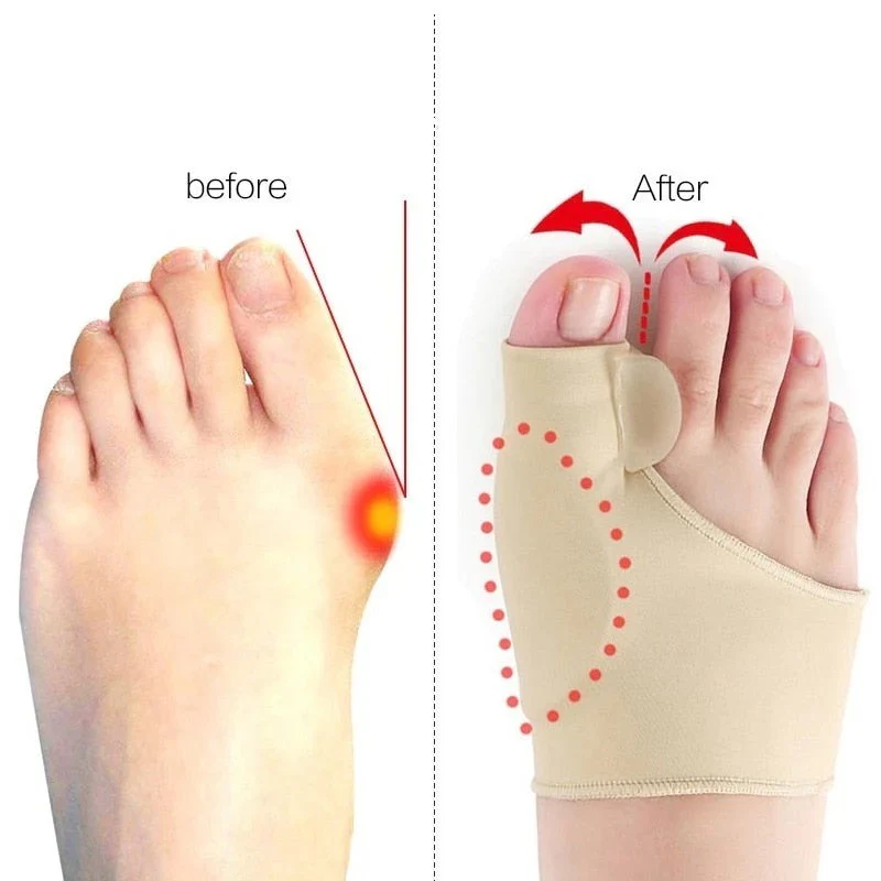 BowLift | Toe Separator with Alignment Support