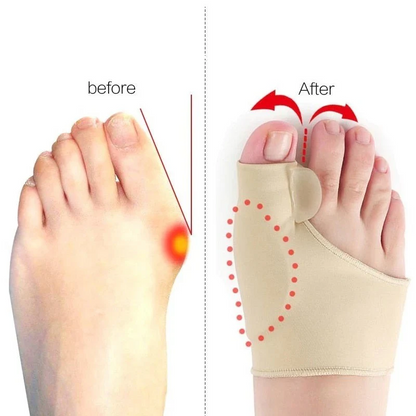 BowLift | Toe Separator with Alignment Support