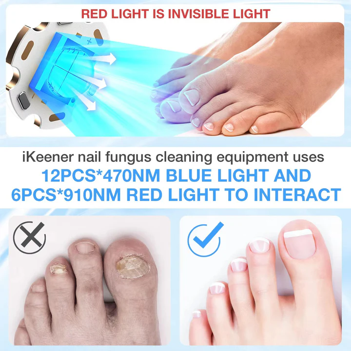 Skanto | Nail Fungus Laser