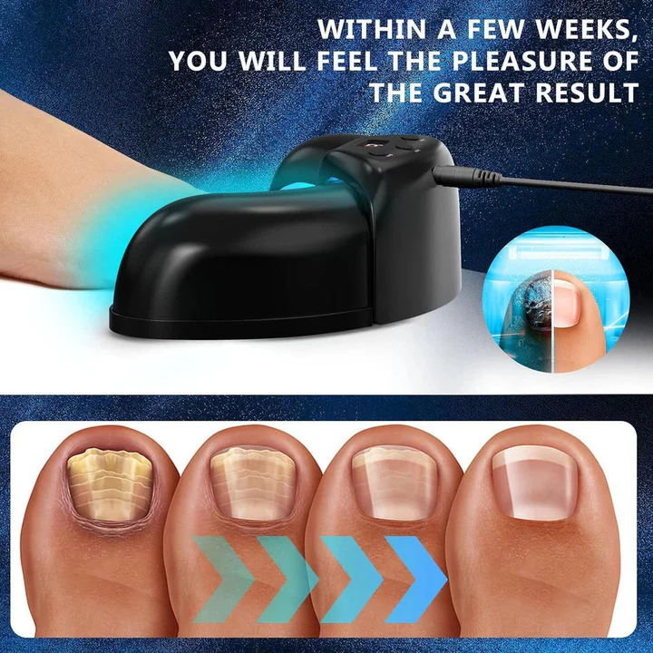 BowLift | Nail Fungus Laser