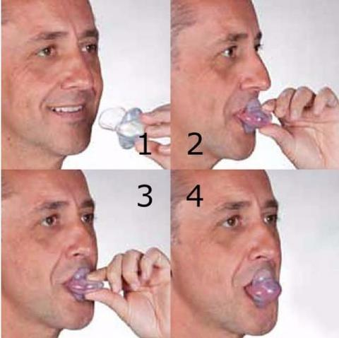 Skanto | Apnea Tongue Stabilizing Device