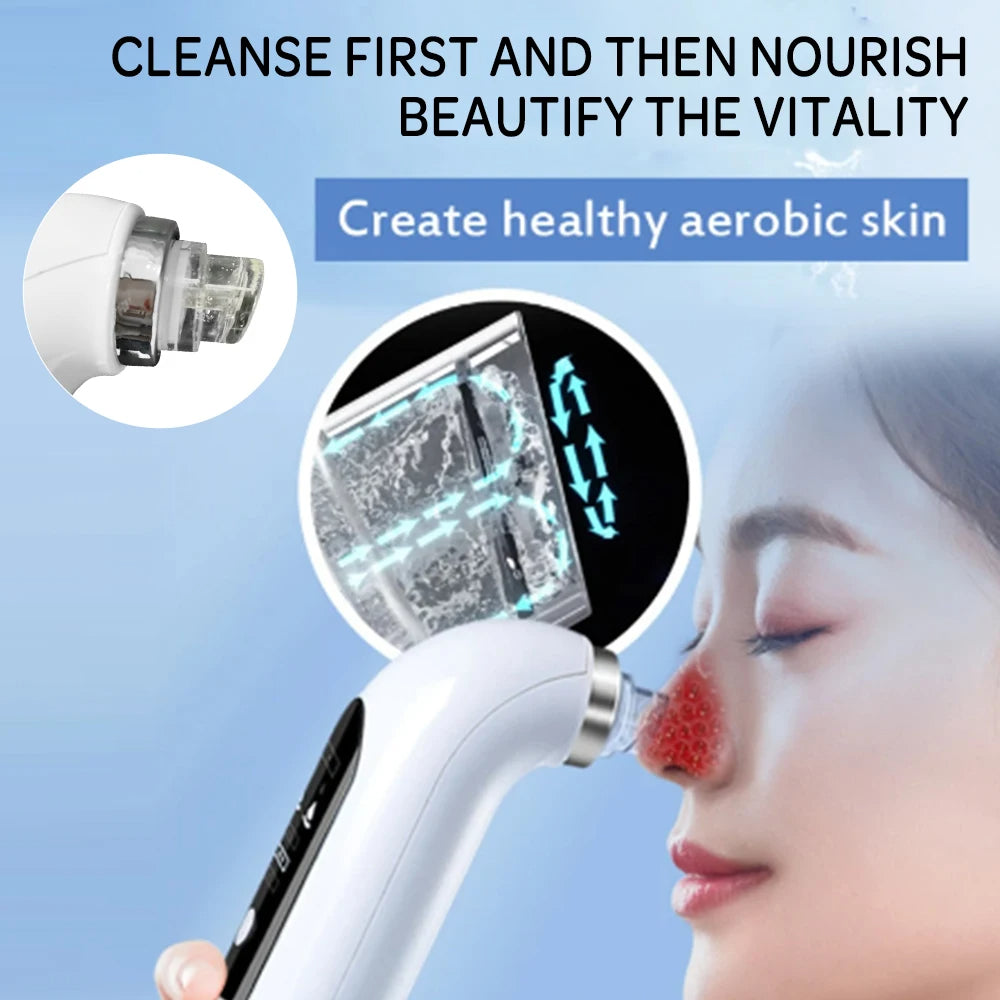 Skanto | Professional Blackhead Remover Vacuum - Deep Cleansing with Suction Technology