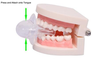Skanto | Apnea Tongue Stabilizing Device