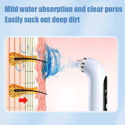 Skanto | Professional Blackhead Remover Vacuum - Deep Cleansing with Suction Technology