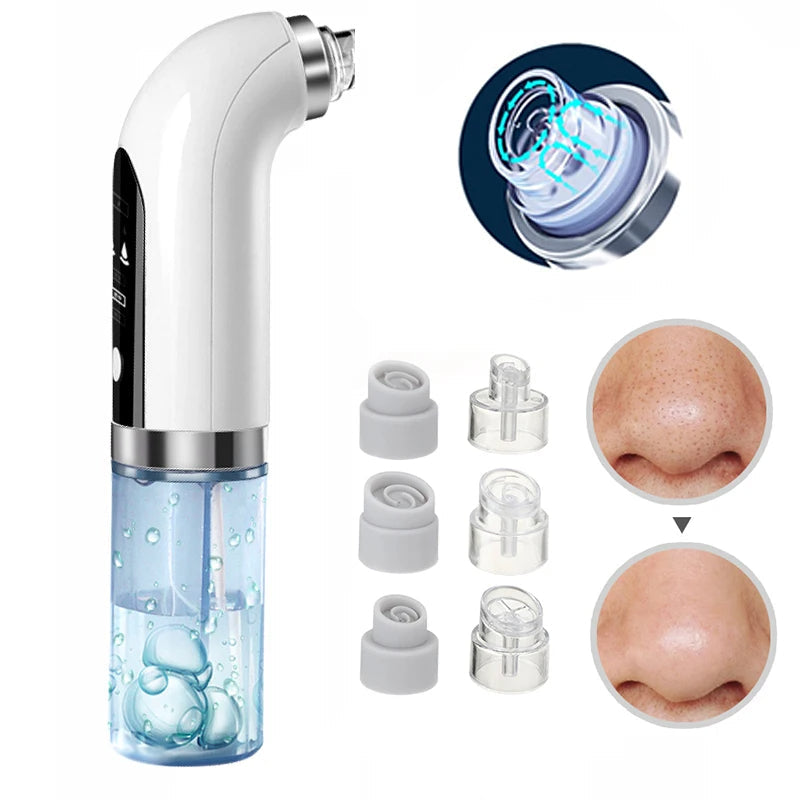 Skanto | Professional Blackhead Remover Vacuum - Deep Cleansing with Suction Technology