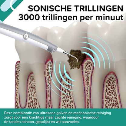 SmileFresh️ | Plaque and Stain Remover