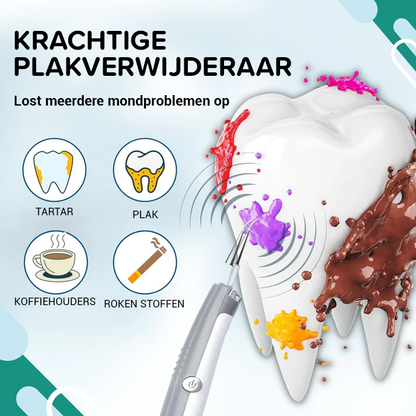 SmileFresh️ | Plaque and Stain Remover