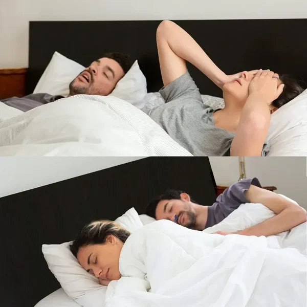 Skanto | Sleepless, Mask-Free, Micro-CPAP Anti-Snoring