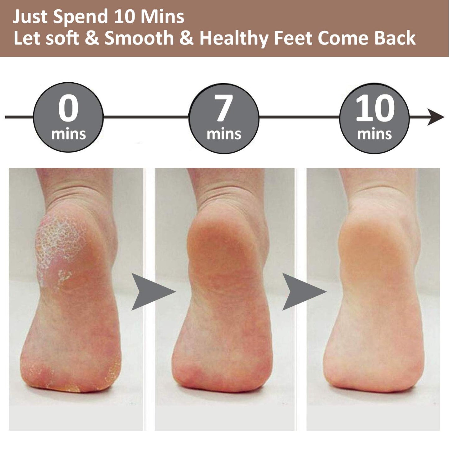 Skanto | Electric Foot Callus Remover