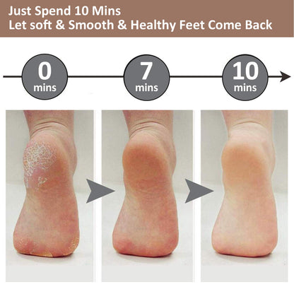 Skanto | Electric Foot Callus Remover