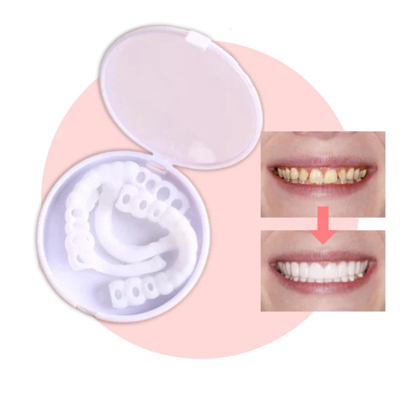 BowLift | SmileSnap - Always the perfect smile with these veneers