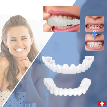 BowLift | SmileSnap - Always the perfect smile with these veneers